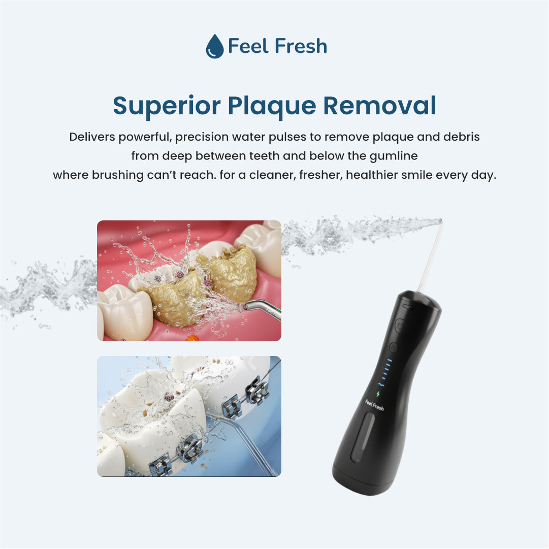 AquaJet+ water flosser Singapore superior plaque removal – powerful precision water pulses remove plaque and debris deep between teeth and below gumline, best water flosser for braces Singapore