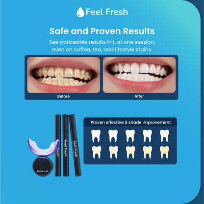 Feel Fresh LumiBright™ Whitening Kit – Premium Teeth Whitening