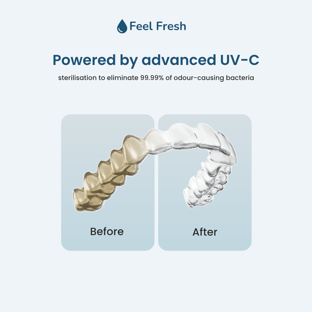 Ultrasonic aligner cleaner Singapore before and after – advanced UV-C sterilisation eliminates 99.99% of odour-causing bacteria, transforming yellowed dirty aligners to crystal clear