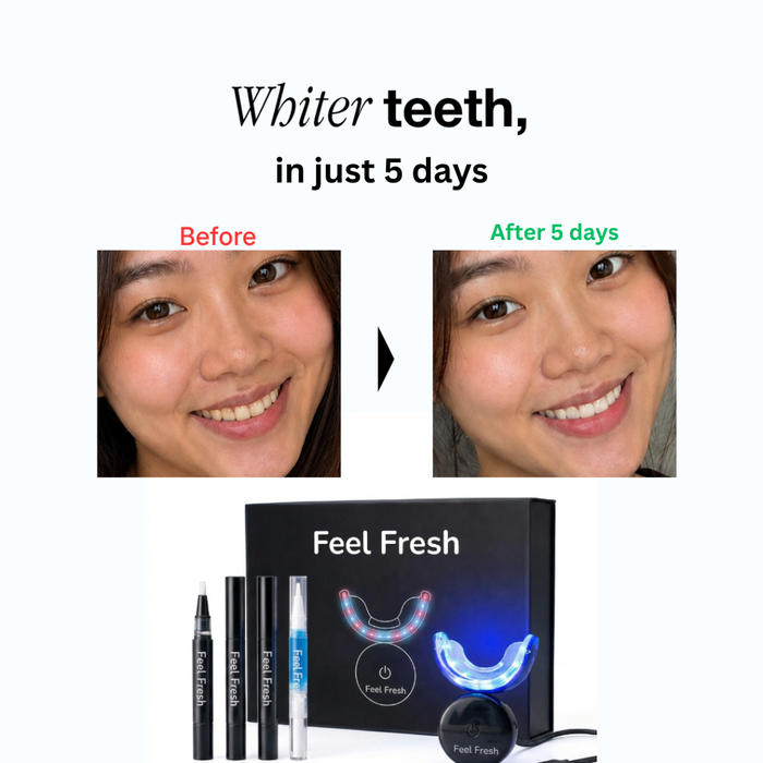 Pain-Free Instant Teeth Whitening Kit