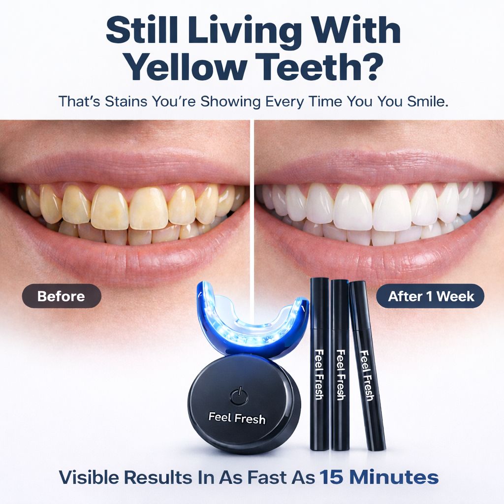 Before and after 1 week teeth whitening results - yellow teeth to white with Feel Fresh kit in 15 minutes