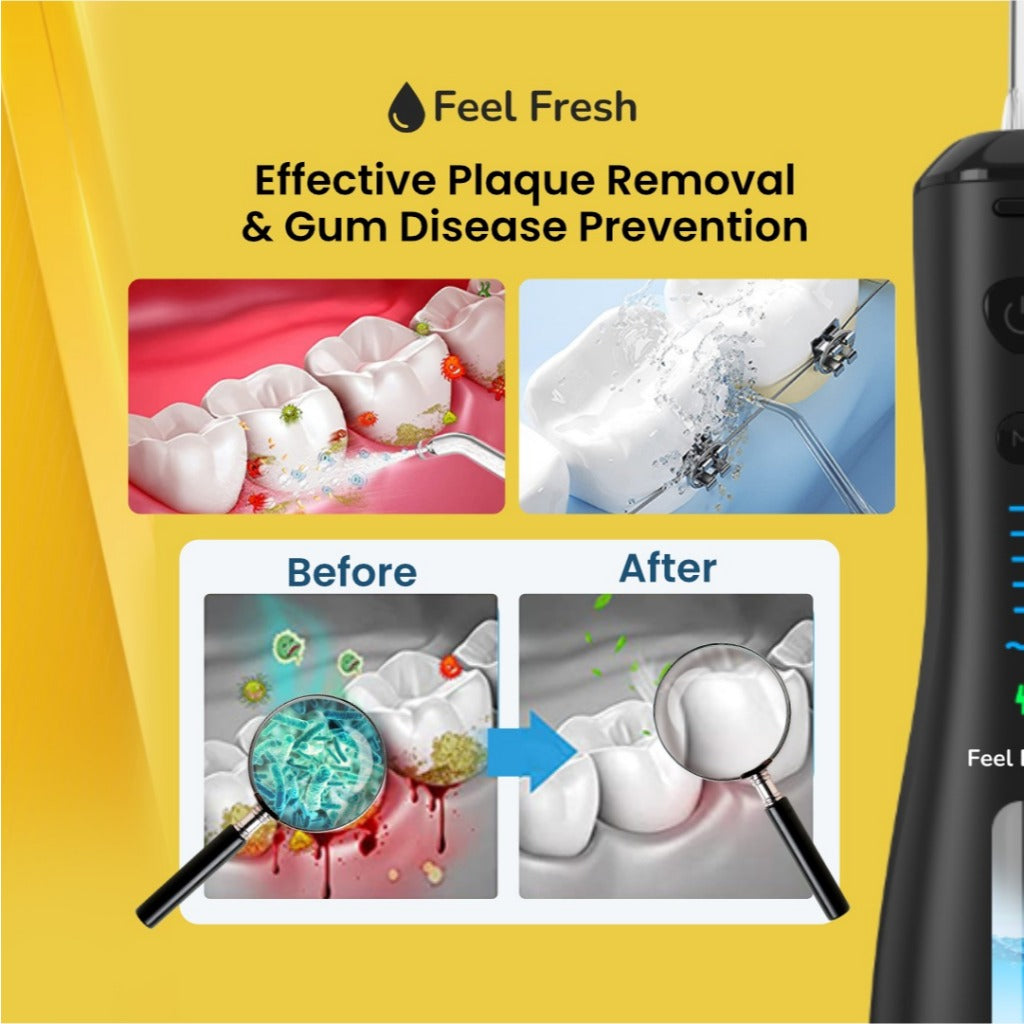 Feel Fresh AquaJet+™  Flosser X'MAS MEGA SALE